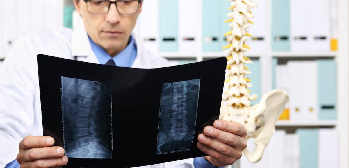 Radiologist doctor checking x-ray, healthcare, medical and radiology concept. (Photo: AdobeStock)