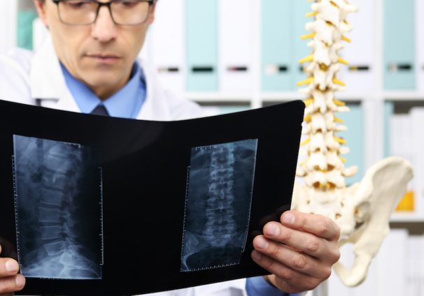 Radiologist doctor checking x-ray, healthcare, medical and radiology concept. (Photo: AdobeStock)